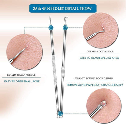 Blackhead Remover Tool – 4-in-1