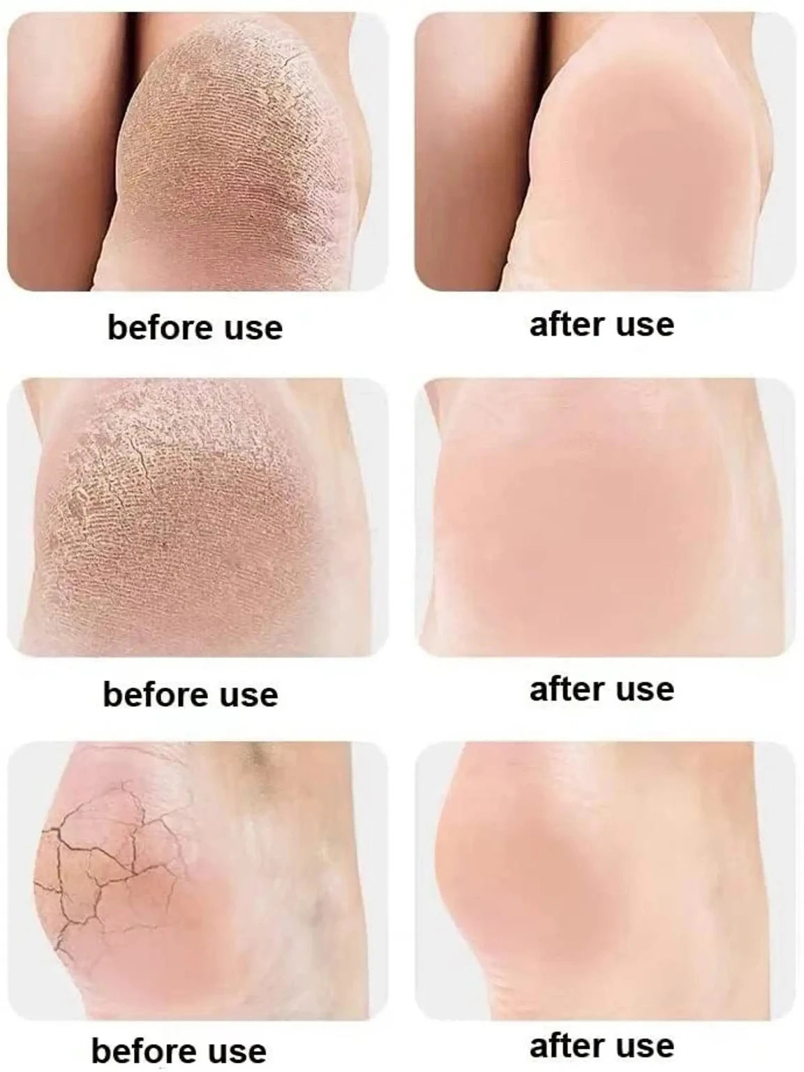 Premium Moisturizing Gel Heel Care Socks