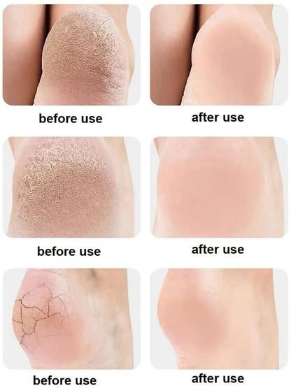 Premium Moisturizing Gel Heel Care Socks